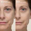 Peter Thomas Roth Instant FirmX No Filter Primer 30ml | Instant Skin Tightening & Blurring Primer | Pore Minimizing & Anti-Aging Formula | Made in USA. 