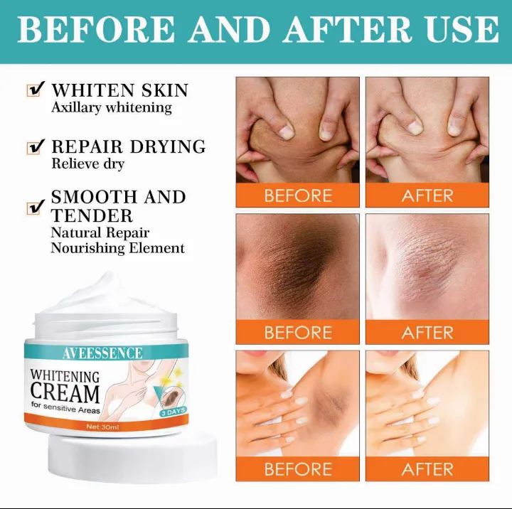 Whitening%20cream%20for%20sensitive%20areas%20underarm%20and%20private%20parts%20of%20body%20men's%20and%20woman%20-%20Image%202