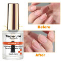 Tinovo Uno Vitamin E Cuticle Oil Nail Art Treatment Nourishment Oil Soften Moisturizing Nail Strengthener Repair Damaged Nails. 