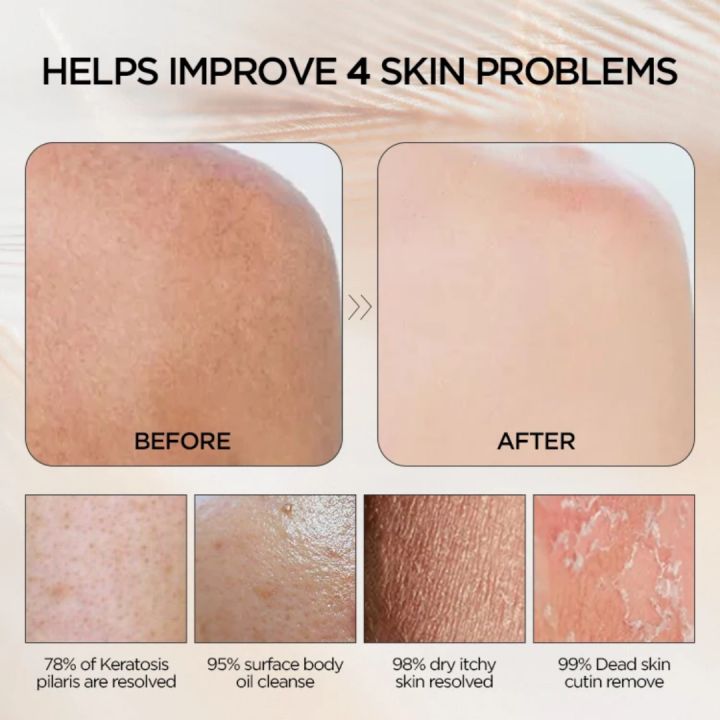 Exfoliating%20Mitt%20bath%20gloves,%20shower%20scrubber,%20body%20scrubbing,%20cleaning%20body%20-1pics%20-%20Image%205