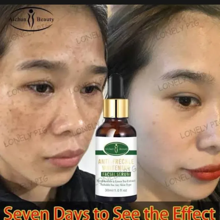 Anti%20Freckles%20whitening%20Facial%20serum%20Nicotinamide%20and%20green%20tea%20extract%20-%20Image%203