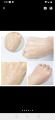 Yeast Eggshell Mask Cream Oil Control Shrink Pores Whitening Moisturizing Cream Anti-Aging Skin Care Face Peel Mask 100g. 
