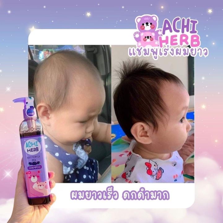 Achiherb%20Children's%20Shampoo%20Accelerates%20Hair%20Growth%20and%20Makes%20It%20Black.%20Achiherb%20Can%20Be%20Used%20by%20All%20Ages.%20Newborns%20-%20Adults%20Hair%20Loss%20after%20Giving%20Birth%20Is%20Good%20for%20Use.%20-%20Image%207