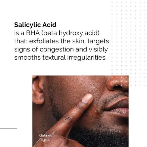 Salicylic%20Acid%20%E2%80%93%20Acne%20Treatment%20Serum%20for%20Blemish%20Control,%20Deep%20Pore-Cleansing%20&%20Blackhead%20Removal%20%7C%20Exfoliating%20Facial%20Serum%20for%20Oily%20Skin,%20Clear%20Skin,%20and%20Pore%20Minimizing%20Solution%20for%20Acne-Prone%20Skin%20-%20Image%208