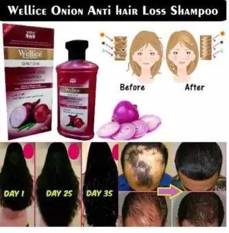 Wellica%20Onion%20Anti%20Hair%20loss%20Shampoo%20for%20Mother%20&%20Baby%20-%20Image%203