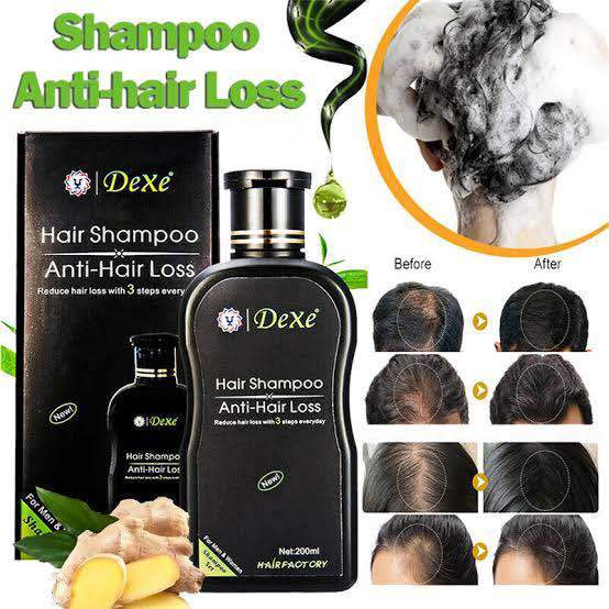 DEXE Anti-Hair Loss Hair Growth Shampoo Treatment Natural Ingredients 200ml