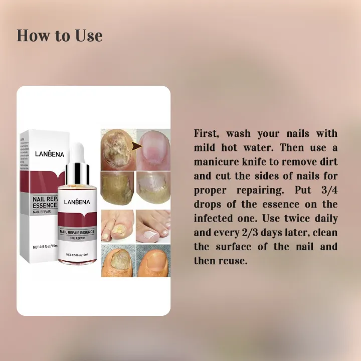 LANBENA%20Nail%20Repair%20Essence%20-%2015ml%20-%20Image%203