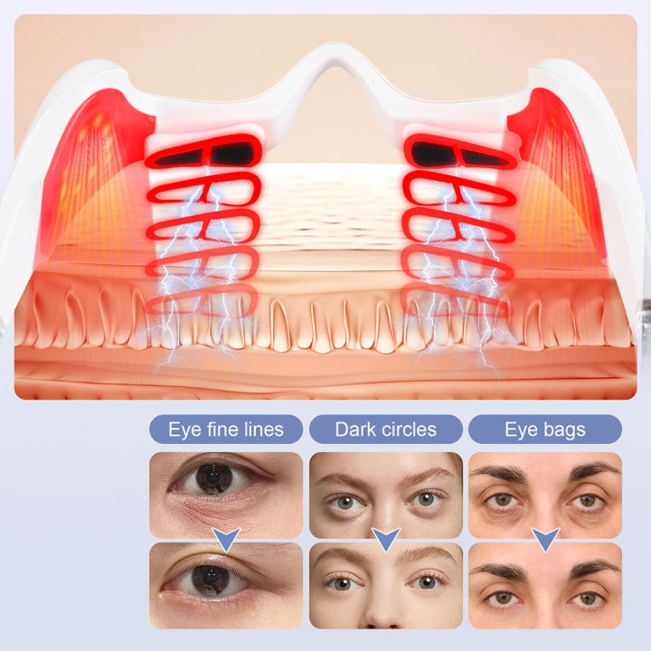Eye%20Massage%20Device%20Eye%20Care%20Lifting%20Tightening%20Dark%20Circles%20Eye%20Bag%20Removal%20-%20Image%204