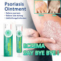 Jemeesen Psoriasis Medicated Treatment Cream. 