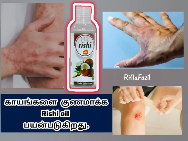 Rishi%20Oil%2080ml%20-%20Image%205