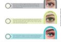 Shade Name: Estonia Blue Soft Colored Contact Lenses / Eye Lenses / Fashion Lenses / Beauty Lenses / Cosmetics Lenses / New Arrival / Only Lens. 