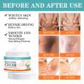 Whitening cream for private parts and sensitive area underarm 7 days result cream. 
