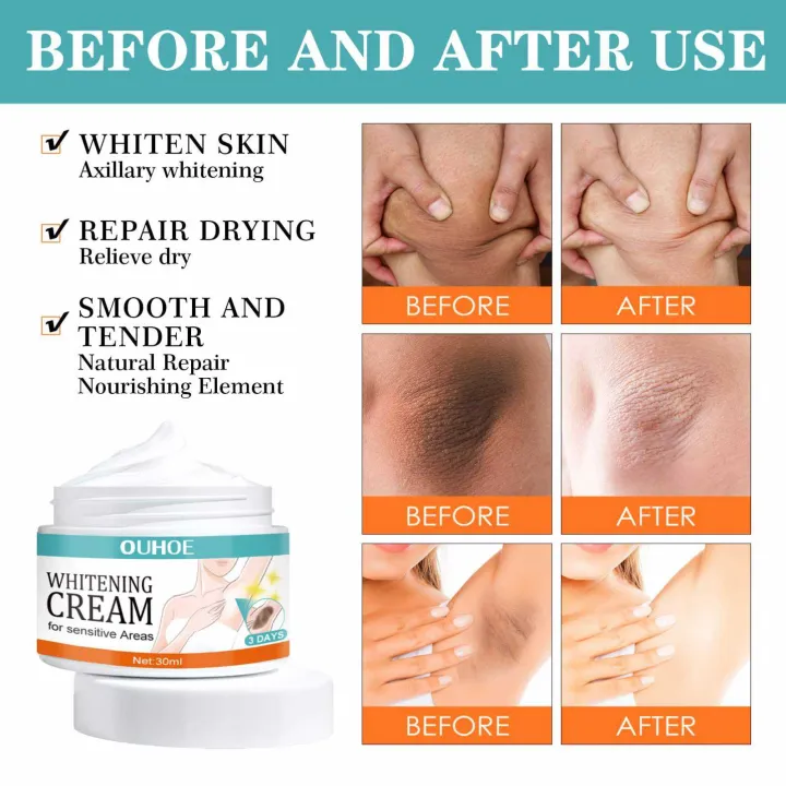Whitening%20cream%20for%20private%20parts%20and%20sensitive%20area%20underarm%207%20days%20result%20cream%20-%20Image%202