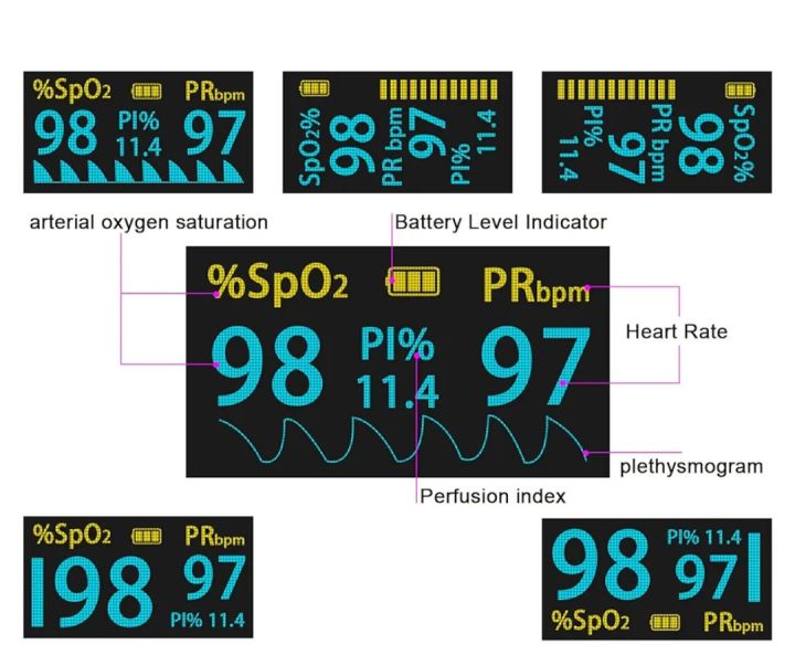 MomMed%20M170%20Digital%20Pulse%20Oximeter%20for%20Finger%20Oxygen%20Measuring%20Device,%20Fingertip%20Oximeter%20Measures%20Oxygen%20Saturation%20SpO2,%20Pulse%20Frequency,%20Oximeter%20with%20OLED%20Display%20and%20Alarm%20Function%20Black%20-%20Image%203
