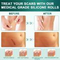 1Roll Professional Silicone Scar Sheets Scars Treatment - Reusable Silicone Scar Strips Type for Keloid, C-Section, Surgery,Burn. 