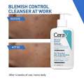 Blemish Control Cleanser | 236ml | Blemish Control Face Wash | Blemish Removal Cleanser | For Blemish Prone Oily Skin | Salicylic Acid | Niacinamide | Ceramides | Gentle Deep Cleansing | Face Care for Clear Smooth Skin. 