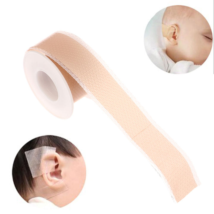 Silicone Baby Ear Correctors - 4x50cm Protruding Ear Patch Stickers For Newborns & Infants