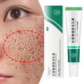 MoupBoi Salicylic Acid Shrink Pore Cream Elimination Large Pores Quick Remove Blackehead Tighten Face Smooth Repairing Skin Care Product Phone case.