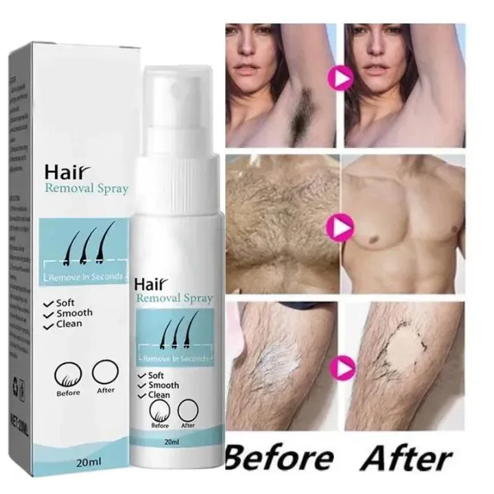 Swanwany%20Permanent%20Hair%20Removal%20Spray%20Painless%20Hair%20Remover%20for%20Ladies%20Armpit%20Legs%20Arms%20Hair%20Growth%20Inhibitor%20Depilatory%20Body%20Cream%20Care%20phone%20case%20-%20Image%202