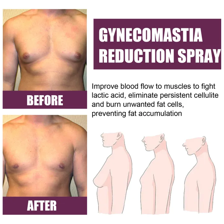 Gynecomastia%20Firming%20Spray%20Male%20Breast%20Growth%20Accelerating%20Pectoral%20Muscles%20Hardening%20Shrinking%20Chest%20Cellulite%20Reduction%20Spray%20-%20Image%206