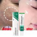 MoupBoi Salicylic Acid Shrink Pore Cream Elimination Large Pores Quick Remove Blackehead Tighten Face Smooth Repairing Skin Care Product Phone case.