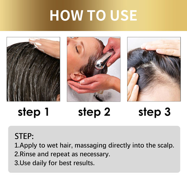 TopZ%20Fast%20Anti%20Dandruff%20Hair%20Oil%20Control%20Treatment%20Relieve%20Itching%20Repair%20Scalp%20Cleaning%20Exfoliating%20Products%20Antipruritic%20Hair%20Care%20Phone%20case%20-%20Image%206