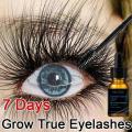 Swanwany 7 Days Fast Eyelash Growth Serum Natural Eyelashes Enhancer Longer Thicker Eyebrows Lift Eye Care Fuller Lashes Products phone case. 