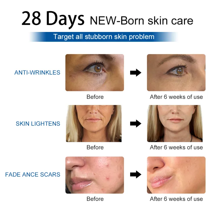autistictic%20Lescolton%20PDT%20Led%20Mask%20Facial%20Light%20Threapy%20Machine%20Foldable%207%20Color%20Face%20Lamp%20Photon%20Skin%20Rejuvenation%20Salon%20Home%20Use%20Skin%20Care%7CLED%20Mask%7C%20%20%20-%20AliExpress%20phone%20case%20-%20Image%207