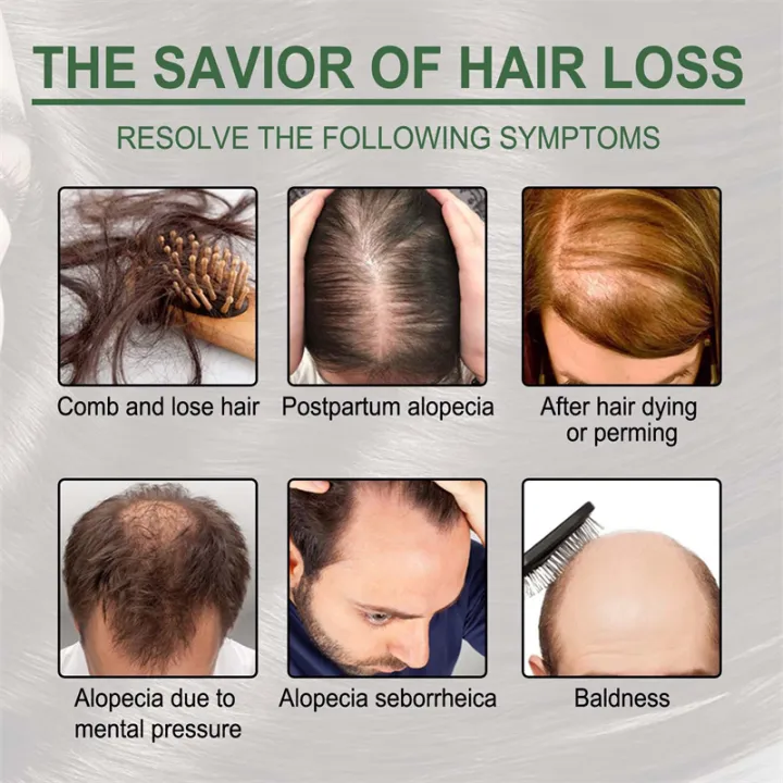 In%20blue%20In%2030Pcs%20Rosemary%20Essential%20Oil%20Smooth%20Silky%20Hair%20Vitamin%20Capsule%20Nourishing%20Treatment%20Repair%20Damaged%20Hair%20Serum%20Strengthen%20Hair%20phone%20case%20-%20Image%207