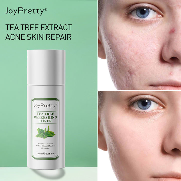 Joypretty%206pcs%20Face%20Skin%20Care%20Set%20Tea%20Tree%20Extract%20Acne%20Removal%20Improve%20Pores%20Face%20Cream%20Cleanser%20Repair%20Korean%20Cosmetics%20Kit%20-%20Facial%20Care%20Sets%20&%20Kits%20-%20AliExpress%20-%20Image%205
