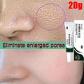 Swanwany Salicylic Acid Pores Shrink Refining Cream Repair Large Open Pore Remove Black Dots Blackhead Acne Marks Face Skin Care Products phone case.