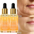 Vitamin C Therapy|vitamin C Facial Serum - Anti-aging, Dark Spot Removal, Collagen Boost.