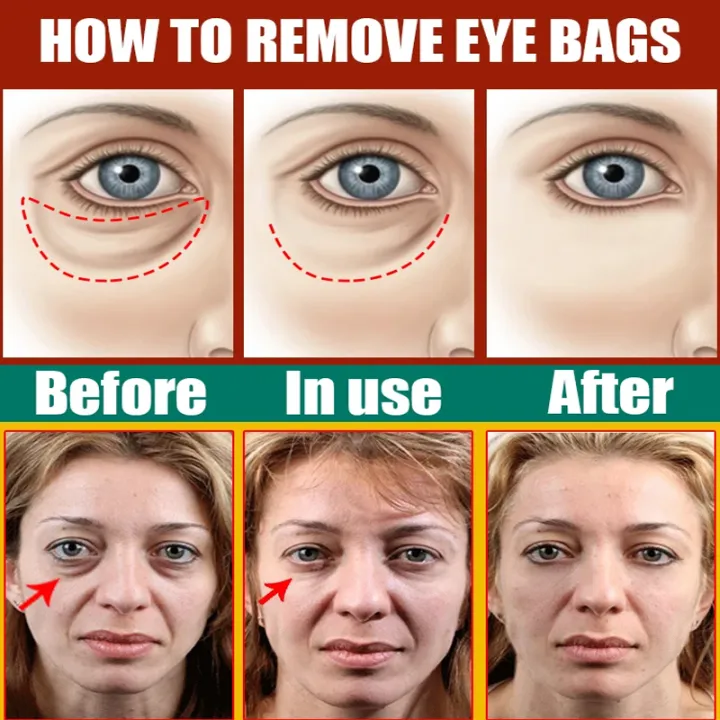 Eyes%20Bag%20Remove%20Collagen%20Eye%20Patch%20Instant%20Fade%20Fine%20Lines%20Dark%20Circles%20Fat%20Particles%20Moisturizing%20Anti%20Puffiness%20Korea%20Eye%20Care%20-%20Image%206