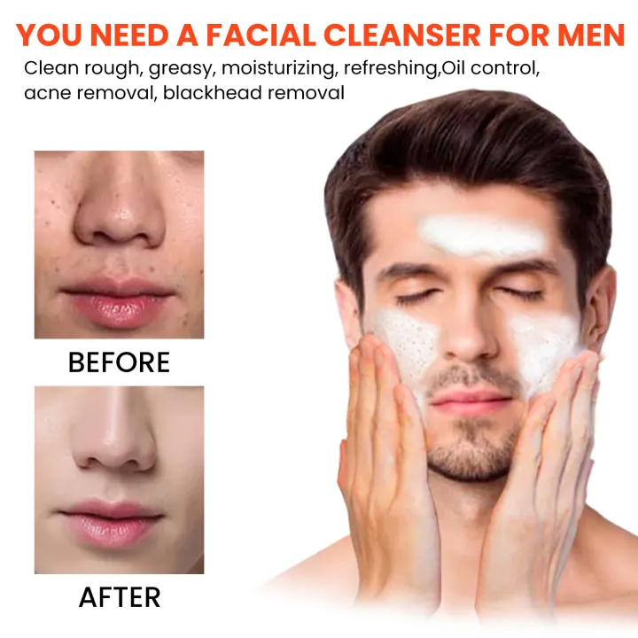 Men%20Facial%20Cleanser%20Wash%20Deep%20Facial%20Cleansing%20Remove%20Acne%20Blackhead%20Shrink%20Pores%20Oil%20Control%20Moisturizing%20Exfoliating%20Skin%20Care%20-%20Image%205
