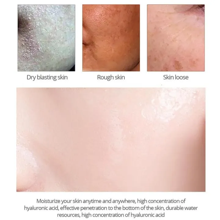 Salicylic%20Acid%20Pore%20Shrinking%20Cream%20Quick%20Elimination%20Large%20Pores%20Remove%20Blackehead%20Tighten%20Face%20Smooth%20Skin%20Korean%20Care%20Product%20-%20Image%205
