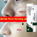 Swanwany Salicylic Acid Pores Shrink Refining Cream Repair Large Open Pore Remove Black Dots Blackhead Acne Marks Face Skin Care Products phone case.