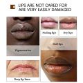 Airline Store  Lip Lightening Balm for Dark Lips Lip Brightener Moisturizing for Smokers Dark Lip Treatment Lightening Cream for Pink Lips phone case. 