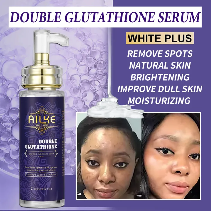 autistictic%20AILKE%20Glutathione%205%20in%201%20Women%20Skin%20Care%20Kit,%20With%20Body%20Lotion,%20%20Serum,%20Dark%20Spot%20Removal%20Cream,%20Body%20Cream,%20Brightening%20Soap%20phone%20case%20-%20Image%206
