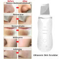 Ultrasonic Skin Scrubber Peeling Blackhead Remover Deep Face Cleaning Skin Scrubber Acne Pore Cleaner Facial Shovel Cleanser. 