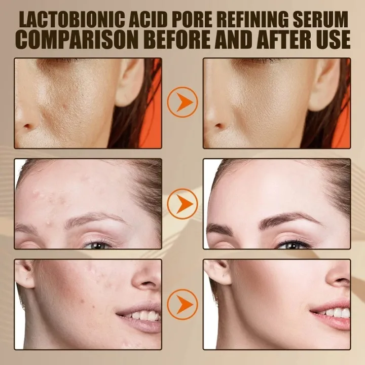 Vitamin%20C%20Therapy%7Cvitamin%20C%20Facial%20Serum%20-%20Anti-aging,%20Dark%20Spot%20Removal,%20Collagen%20Boost%20-%20Image%203
