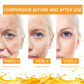 Vitamin C Therapy|vitamin C Facial Serum - Anti-aging, Dark Spot Removal, Collagen Boost.
