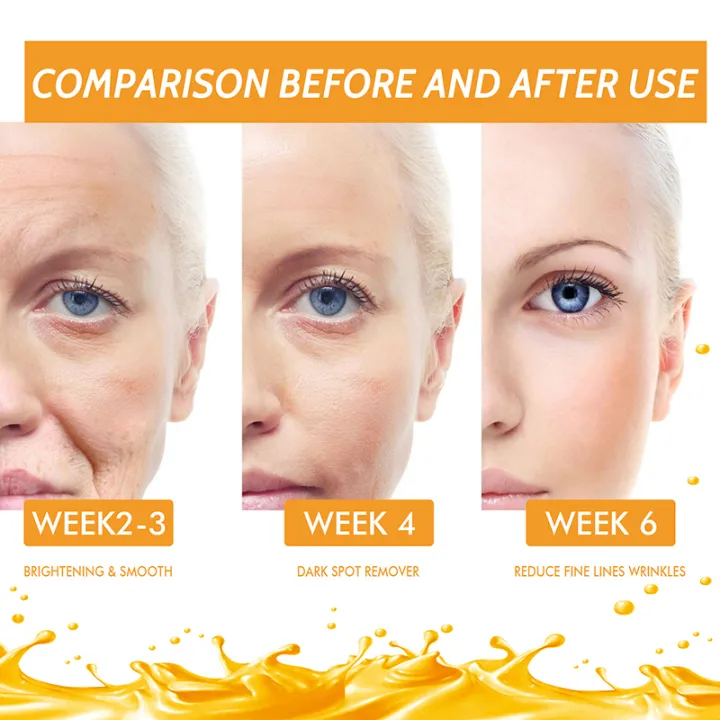 Vitamin%20C%20Therapy%7Cvitamin%20C%20Facial%20Serum%20-%20Anti-aging,%20Dark%20Spot%20Removal,%20Collagen%20Boost%20-%20Image%204