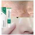 MoupBoi Salicylic Acid Shrink Pore Cream Elimination Large Pores Quick Remove Blackehead Tighten Face Smooth Repairing Skin Care Product Phone case.