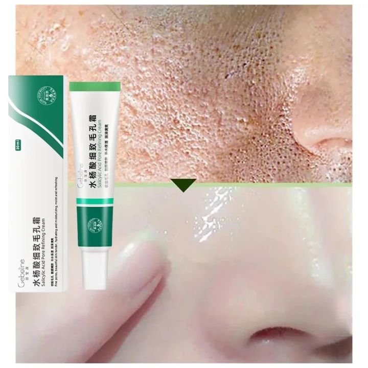 MoupBoi%20Salicylic%20Acid%20Shrink%20Pore%20Cream%20Elimination%20Large%20Pores%20Quick%20Remove%20Blackehead%20Tighten%20Face%20Smooth%20Repairing%20Skin%20Care%20Product%20Phone%20case%20-%20Image%202