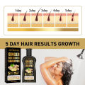 TopZ Ginger Essence Shampoo Anti Hair Loss Oil Control Dandruff Removal Moisturizing Nourishing Scalp Repair Damaged Regrowth Shampoo phone case. 