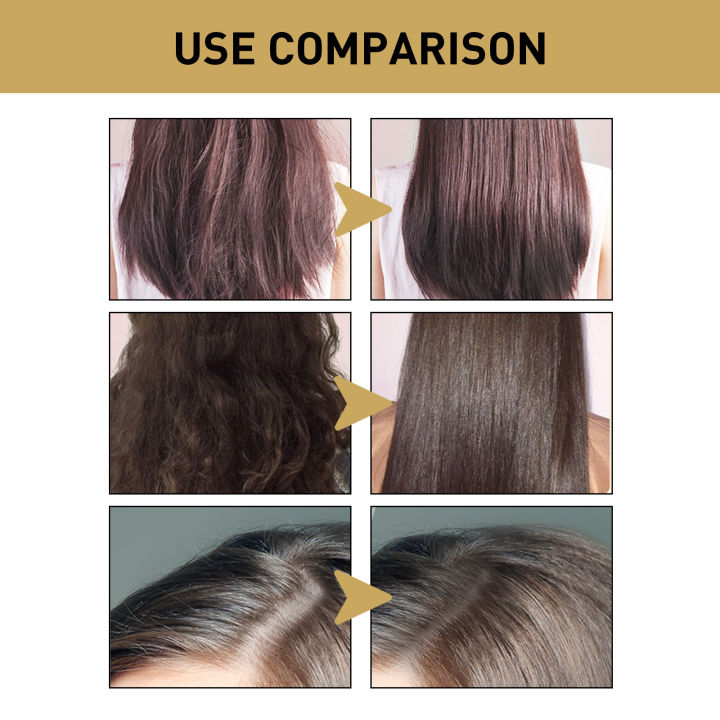 TopZ%20Ginger%20Essence%20Shampoo%20Anti%20Hair%20Loss%20Oil%20Control%20Dandruff%20Removal%20Moisturizing%20Nourishing%20Scalp%20Repair%20Damaged%20Regrowth%20Shampoo%20phone%20case%20-%20Image%204