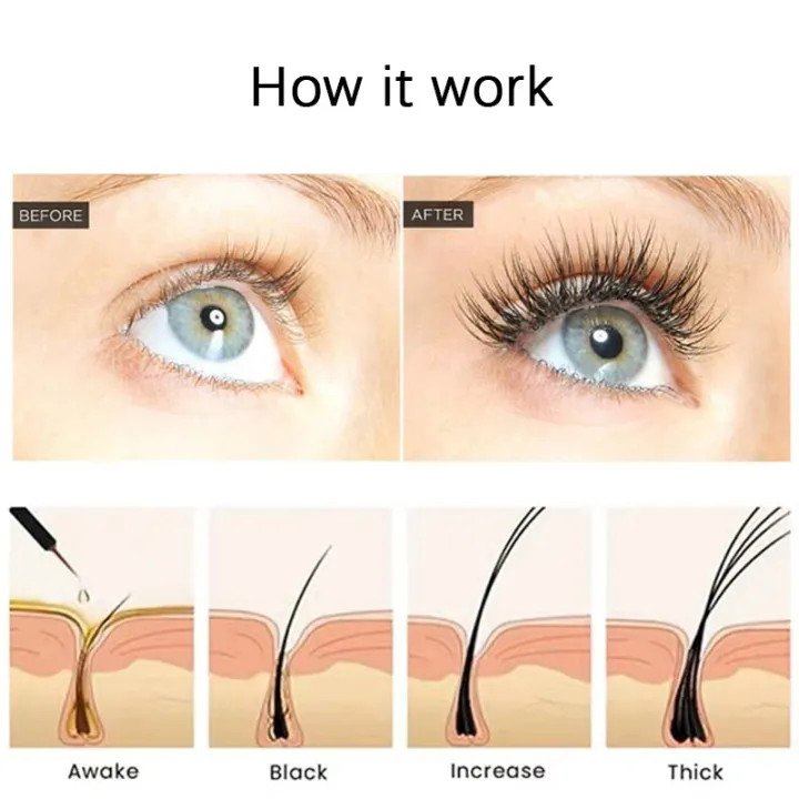 MoupBoi%20Gollee%206ml%20Eyelash%20Growth%20Serum%20Promotes%20Thicker%20Growth%20Lifting%20Eyelashes%20Gentle%20Eyebrows%20Enhancer%20Natural%20Eyelash%20Treament%20Care%20Phone%20Case%20-%20Image%203
