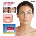 Melasma Remover Cream Removal Dark Pigment Brighten Cream Face Fade Dull Skin Cream Nicotinamide Brightening Moisturize Emulsion. 