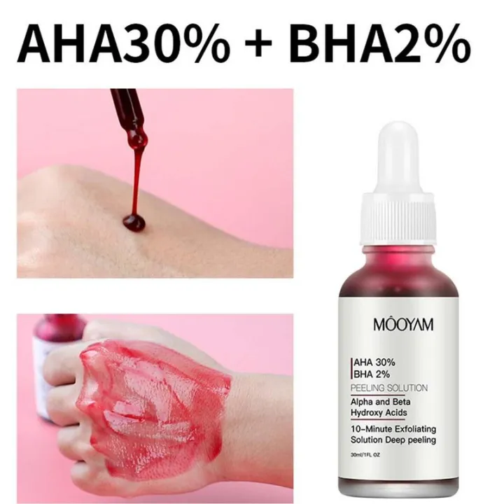 In%20blue%20In%20New%20Face%20Makeup%20Peeling%20Solution%20AHA%2030%25%20+%20BHA%202%25%20Acne%20Removing%20Serum%20Repair%20Hyaluronic%20Acid%20Face%20Skin%20Care%20Treatments%20phone%20case%20-%20Image%202