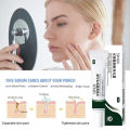 Swanwany Salicylic Acid Pores Shrink Refining Cream Repair Large Open Pore Remove Black Dots Blackhead Acne Marks Face Skin Care Products phone case.